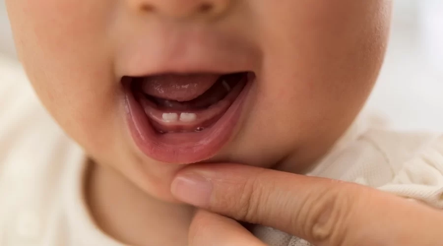 Bebeklikten Çocukluğa Sağlıklı Dişler